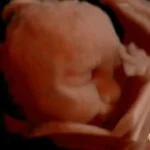 HD_Ultrasound_1 HD_Ultrasound_1