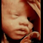 HD_Ultrasound_11 HD_Ultrasound_11