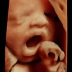 HD_Ultrasound_12 HD_Ultrasound_12
