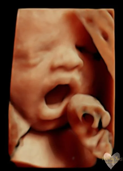 HD_Ultrasound_12 HD_Ultrasound_12