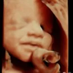 HD_Ultrasound_13 HD_Ultrasound_13