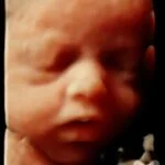 HD_Ultrasound_14 HD_Ultrasound_14