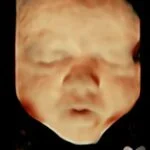 HD_Ultrasound_15 HD_Ultrasound_15