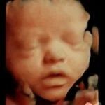 HD_Ultrasound_16 HD_Ultrasound_16