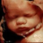 HD_Ultrasound_17 HD_Ultrasound_17