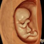 HD_Ultrasound_18 HD_Ultrasound_18
