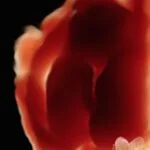 HD_Ultrasound_19 HD_Ultrasound_19