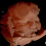 HD_Ultrasound_2 HD_Ultrasound_2