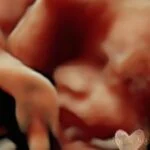 HD_Ultrasound_21 HD_Ultrasound_21