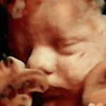 HD_Ultrasound_22 HD_Ultrasound_22