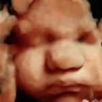HD_Ultrasound_23 HD_Ultrasound_23