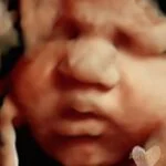 HD_Ultrasound_24 HD_Ultrasound_24