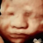 HD_Ultrasound_25 HD_Ultrasound_25