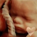 HD_Ultrasound_27 HD_Ultrasound_27