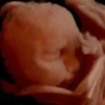 HD_Ultrasound_3 HD_Ultrasound_3