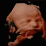 HD_Ultrasound_4 HD_Ultrasound_4