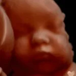 HD_Ultrasound_5 HD_Ultrasound_5