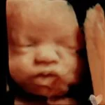 HD_Ultrasound_6 HD_Ultrasound_6