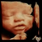 HD_Ultrasound_7 HD_Ultrasound_7