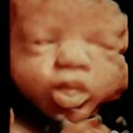 HD_Ultrasound_8 HD_Ultrasound_8