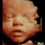 HD_Ultrasound_9 HD_Ultrasound_9