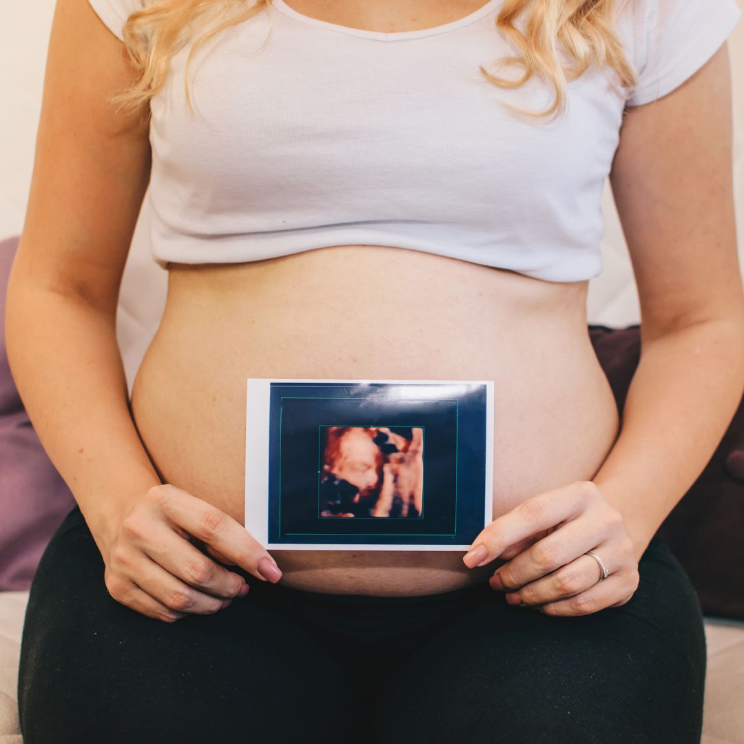 a woman holding a 3D ultrasound in front of her belly