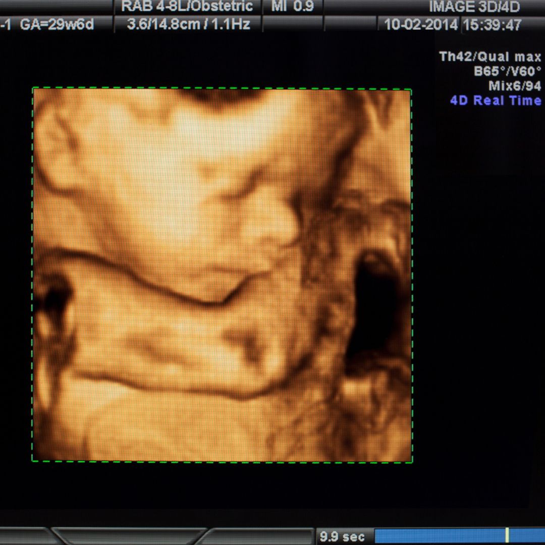 39 Weeks Pregnant 3d Ultrasound