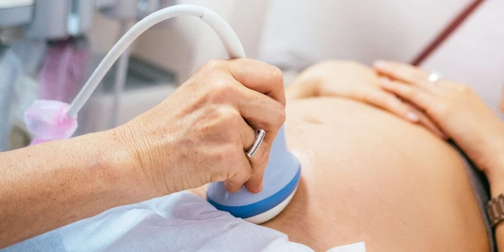 Hero Image- How Do I Prepare for a 4D Ultrasound 4D Ultrasound hero image