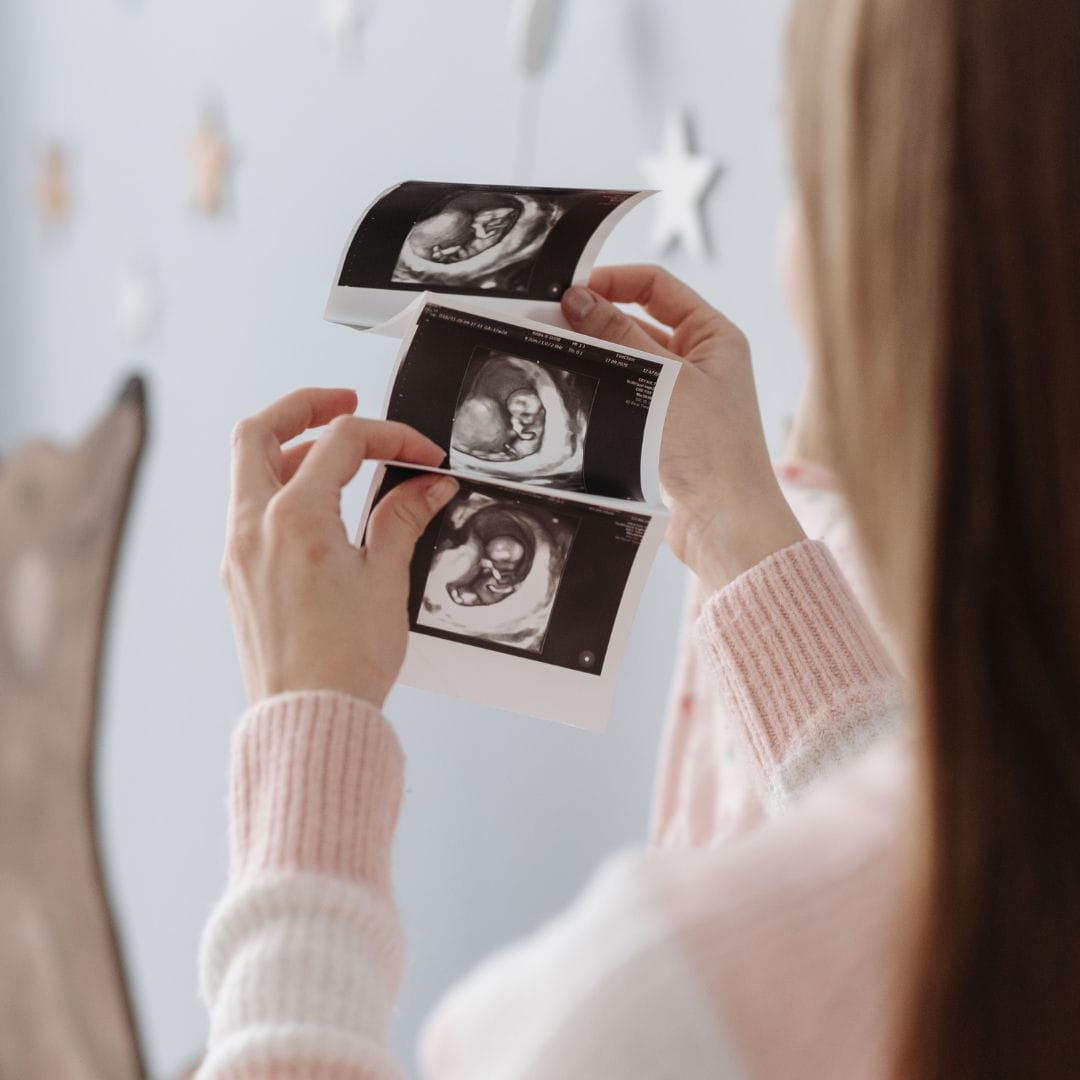 woman looking at ultrasound pictures